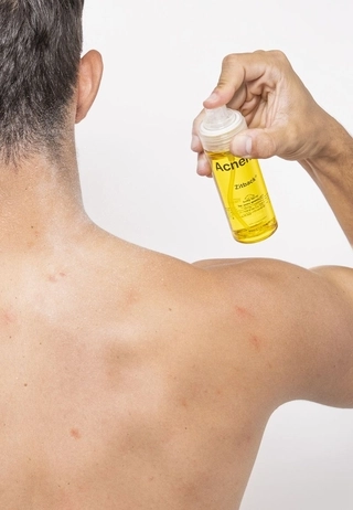 Zitback® спрей для тіла (для шкіри, схильної до акне) 80 мл