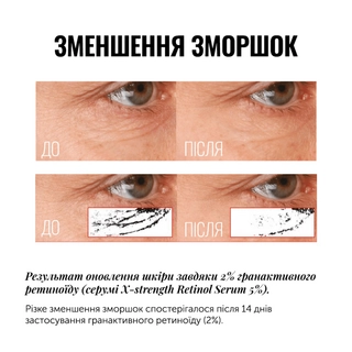 СИРОВАТКА З РЕТИНОЇДОМ PRO-GRADE ANTI-AGING X-STRENGTH RETINOL SERUM , 30 ml